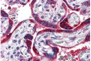 Human Placenta (formalin-fixed, paraffin-embedded) stained with PPARG antibody ABIN351540 at 2. (PPARG Antikörper  (AA 1-16))