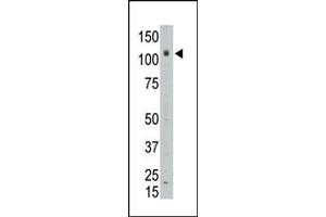 The anti-LAF4 Pab (ABIN6243472 and ABIN6578970) is used in Western blot to detect LAF4 in placenta tissue lysate. (AFF3 Antikörper  (C-Term))