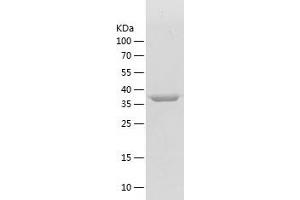 PPID Protein (AA 2-370) (His tag)