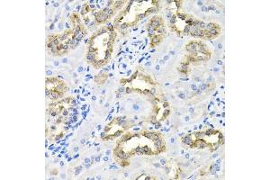 Immunohistochemistry of paraffin-embedded rat kidney using CDC antibody (ABIN6127612, ABIN6138273, ABIN6138274 and ABIN6216282) at dilution of 1:100 (40x lens). (CDCA8 Antikörper  (AA 1-280))