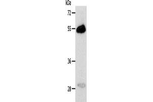 Western Blotting (WB) image for anti-Carbonic Anhydrase XIV (CA14) antibody (ABIN2427890) (CA14 Antikörper)