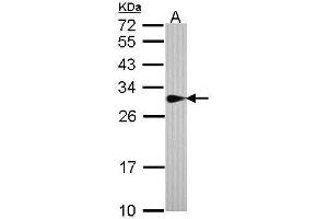 WB Image Sample (30 ug of whole cell lysate) A: A431 , 12% SDS PAGE antibody diluted at 1:1000 (SPR Antikörper)