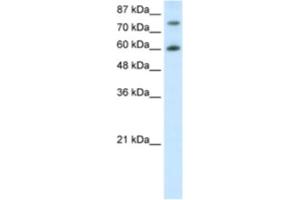 Western Blotting (WB) image for anti-Cleavage Stimulation Factor, 3' Pre-RNA, Subunit 3, 77kDa (CSTF3) antibody (ABIN2462105) (CSTF3 Antikörper)