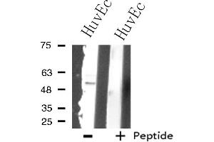 Western blot analysis of extracts from HuvEc cells using SUPT3 antibody. (SUPT3H/SPT3 Antikörper  (Internal Region))