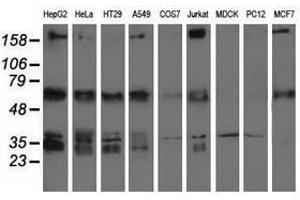 Image no. 2 for anti-Insulin-Like Growth Factor 2 mRNA Binding Protein 2 (IGF2BP2) antibody (ABIN1498825) (IGF2BP2 Antikörper)