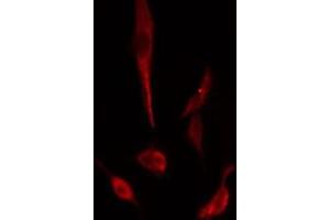 ABIN6274965 staining  Hela cells by IF/ICC. (CBR3 Antikörper  (C-Term))