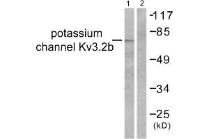 Western blot analysis of extracts from HepG2 cells, using Potassium Channel Kv3. (Kv3.2b Potassium Channel Antikörper  (C-Term))