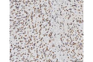IHC analysis of RPL10 using anti-RPL10 antibody (ABIN7601177).