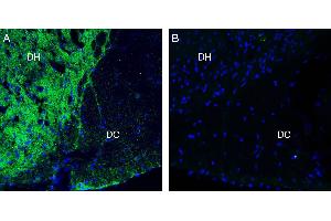 Expression of Neurofascin in rat spinal cord. (Neurofascin (NFASC) Peptid)