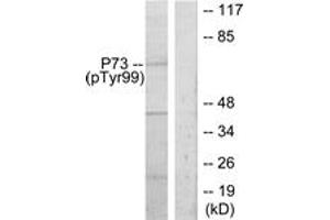 Western blot analysis of extracts from K562 cells treated with Pervanadate, using p73 (Phospho-Tyr99) Antibody. (Tumor Protein p73 Antikörper  (pTyr99))