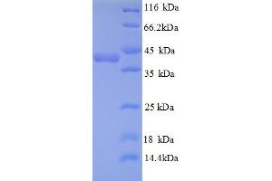 SDS-PAGE (SDS) image for Thioredoxin Domain Containing 17 (TXNDC17) (AA 1-123), (full length) protein (GST tag) (ABIN5710573) (TXNDC17 Protein (AA 1-123, full length) (GST tag))