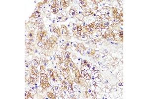 Immunohistochemistry of paraffin-embedded human liver using CYP3 antibody (ABIN3023345, ABIN3023346, ABIN3023347 and ABIN6219639) at dilution of 1:100 (40x lens). (CYP3A4 Antikörper  (AA 244-503))
