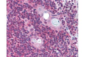 Anti-PAFAH1B1 / LIS1 antibody IHC of human thymus.