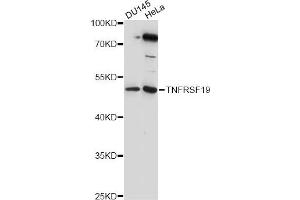 Western blot analysis of extracts of various cell lines, using TNFRSF19 antibody (ABIN6290995) at 1:1000 dilution. (TNFRSF19 Antikörper)