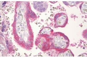 Anti-CGB / hCG Beta antibody IHC staining of human placenta, trophoblast.