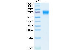 SDS-PAGE (SDS) image for Interleukin 18 Receptor 1 (IL18R1) (AA 20-326) protein (His tag) (ABIN7274982)