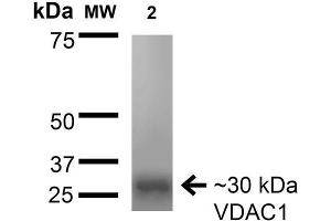 Western Blot analysis of Rat Brain Membrane showing detection of ~30 kDa VDAC1 protein using Mouse Anti-VDAC1 Monoclonal Antibody, Clone S152B-23 .