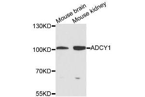 Western blot analysis of extracts of various cell lines, using ADCY1 antibody (ABIN5996345) at 1/1000 dilution. (ADCY1 Antikörper)
