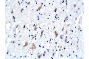 Formalin-fixed and paraffin embedded rat brain labeled with Anti- 5-HTR3Polyclonal Antibody, Unconjugated (ABIN677813) followed by conjugation to the secondary antibody and DAB staining (Serotonin Receptor 3A Antikörper  (AA 301-400))