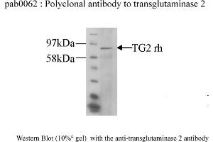 Image no. 1 for anti-Transglutaminase 2 (C Polypeptide, Protein-Glutamine-gamma-Glutamyltransferase) (TGM2) antibody (ABIN347018) (Transglutaminase 2 Antikörper)