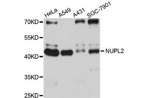 Western blot analysis of extracts of various cell lines, using NUPL2 antibody (ABIN4904603) at 1:1000 dilution. (NUPL2 Antikörper)