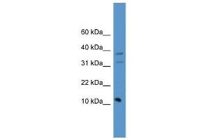 PSENEN antibody used at 0. (PEN2 Antikörper  (C-Term))
