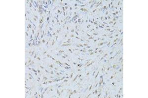 Immunohistochemistry (Paraffin-embedded Sections) (IHC (p)) image for anti-TAR DNA Binding Protein (TARDBP) (AA 1-260) antibody (ABIN3021656)