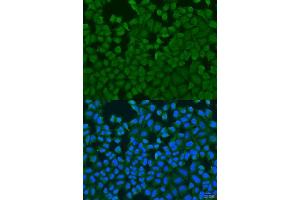 Immunofluorescence analysis of U2OS cells using IL27RA antibody. (IL27 Receptor alpha Antikörper  (AA 33-283))