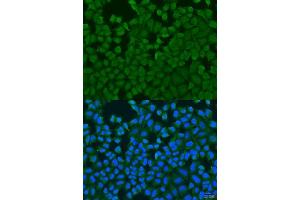 Immunofluorescence analysis of U2OS cells using IL27RA antibody. (IL27 Receptor alpha Antikörper  (AA 33-283))