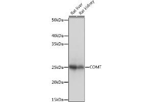 Western blot analysis of extracts of various cell lines, using COMT Rabbit mAb (ABIN1682443, ABIN3018925, ABIN3018926 and ABIN7101689) at 1:1000 dilution. (COMT Antikörper)