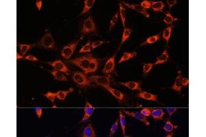 Immunofluorescence (IF) image for anti-Inositol 1,4,5-Trisphosphate Receptor, Type 3 (ITPR3) antibody (ABIN7256360)