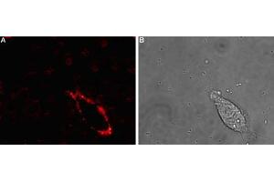 Expression of NaVβ4 in rat PC12 cellsCell surface detection of NaVβ4 in intact living rat pheochromocytoma (PC12) cells.