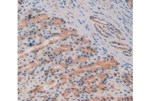 Used in DAB staining on fromalin fixed paraffin- embedded stomach tissue (C8B Antikörper  (AA 161-503))