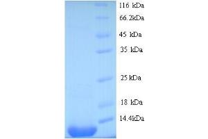 SDS-PAGE (SDS) image for Shiga Toxin Subunit B (STXB) (AA 20-89) protein (His tag) (ABIN5714176) (STXB Protein (AA 20-89) (His tag))