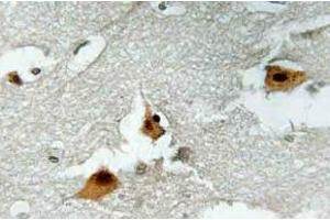 Immunohistochemistry (IHC) analyzes of p-AFX1 in paraffin-embedded human brain tissue. (FOXO4 Antikörper  (pSer197))