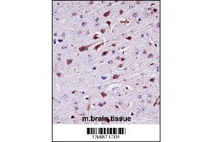 Mouse Ptk2b Antibody immunohistochemistry analysis in formalin fixed and paraffin embedded mouse brain tissue followed by peroxidase conjugation of the secondary antibody and DAB staining.