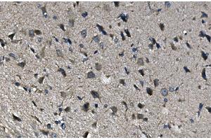 IHC analysis of ADRA1A using anti-ADRA1A antibody (ABIN3043732). (alpha 1 Adrenergic Receptor Antikörper  (C-Term))