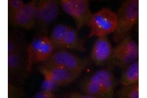 Immunofluorescence staining of methanol-fixed Hela cells using Synaptotagmin 1/2 (Phospho-Thr202/199) Antibody. (SYT1/SYT2 (pThr199), (pThr202) Antikörper)