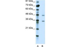 WB Suggested Anti-CBX8 Antibody Titration:  2. (CBX8 Antikörper  (C-Term))