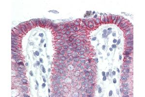 Anti-CTNNB1 / Beta Catenin antibody IHC of human colon. (CTNNB1 Antikörper  (C-Term))