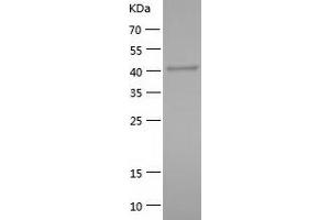 Western Blotting (WB) image for DnaJ (Hsp40) Homolog, Subfamily A, Member 1 (DNAJA1) (AA 1-394) protein (His tag) (ABIN7122690) (DNAJA1 Protein (AA 1-394) (His tag))