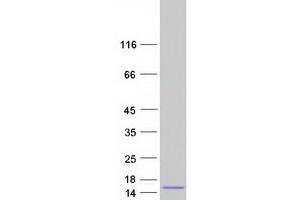 Validation with Western Blot (SPINT3 Protein (Myc-DYKDDDDK Tag))