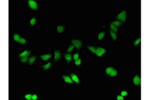 Immunofluorescent analysis of HepG2 cells using ABIN7159517 at dilution of 1:100 (MT1E Antikörper  (AA 4-59))
