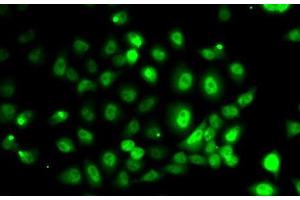 Immunofluorescence analysis of MCF7 cells using PPP2R1B Polyclonal Antibody
