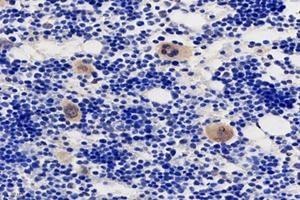 Immunohistochemistry analysis of paraffin-embedded rat bone using,TMEM177 (ABIN7075996) at dilution of 1: 1000 (TMEM177 Antikörper)