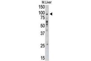 Image no. 1 for anti-Toll-Like Receptor 6 (TLR6) (C-Term) antibody (ABIN357053) (TLR6 Antikörper  (C-Term))