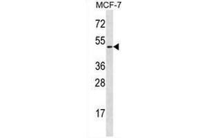 Western blot analysis in MCF-7 cell line lysates (35ug/lane) using Ladinin-1  Antibody (N-term). (Ladinin 1 Antikörper  (N-Term))