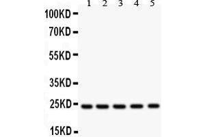 Anti- HSP27 antibody, Western blotting All lanes: Anti HSP27  at 0.