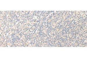 Immunohistochemistry of paraffin-embedded Human tonsil tissue using RADIL Polyclonal Antibody at dilution of 1:40(x200)