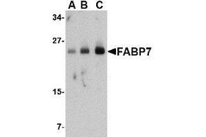 Western blot analysis of FABP7 in human breast tissue lysate with AP30326PU-N FABP7 antibody at (A) 0. (FABP7 Antikörper  (Center))